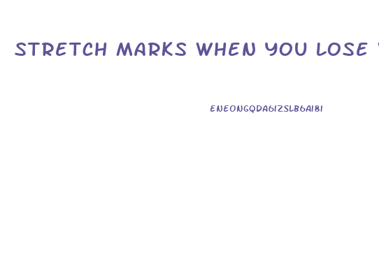Stretch Marks When You Lose Weight