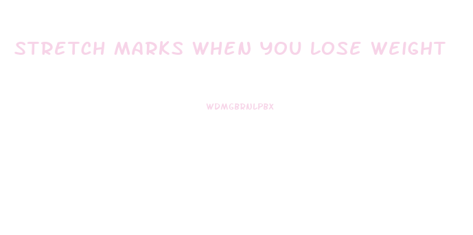 Stretch Marks When You Lose Weight