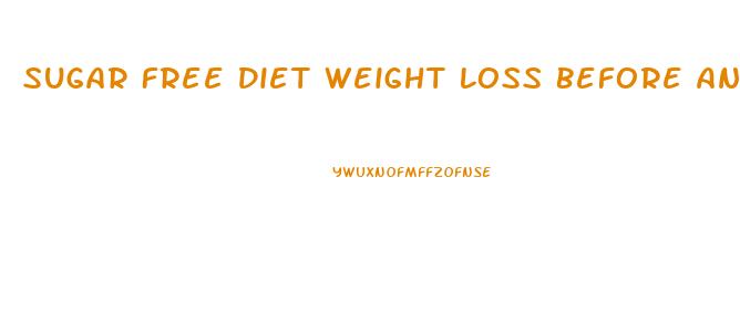 Sugar Free Diet Weight Loss Before And After