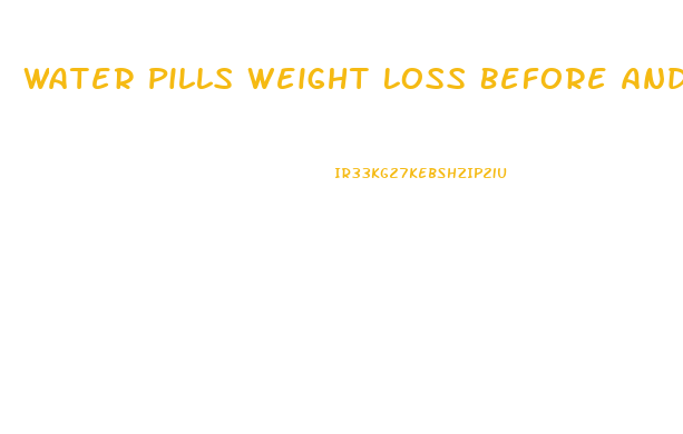 Water Pills Weight Loss Before And After