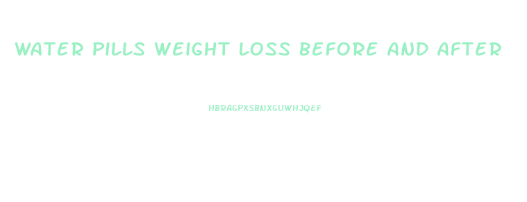 Water Pills Weight Loss Before And After