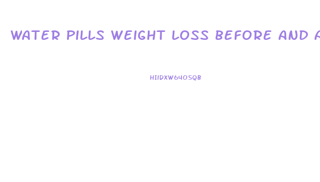 Water Pills Weight Loss Before And After
