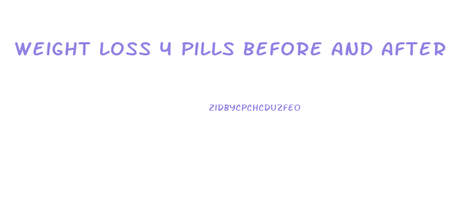 Weight Loss 4 Pills Before And After