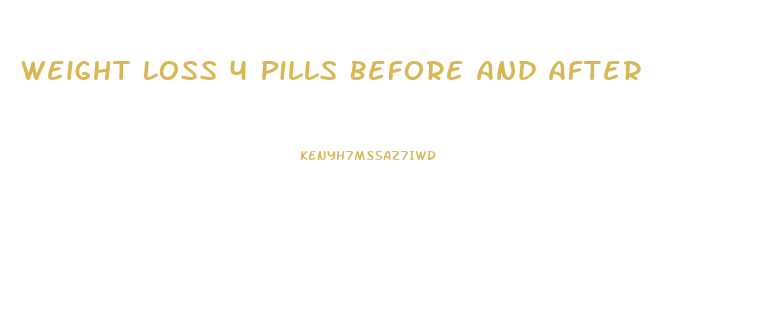 Weight Loss 4 Pills Before And After