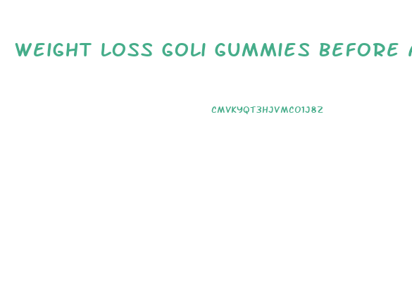 Weight Loss Goli Gummies Before And After Pictures