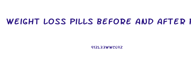 Weight Loss Pills Before And After Pictures