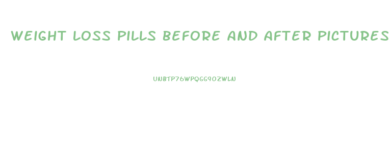 Weight Loss Pills Before And After Pictures