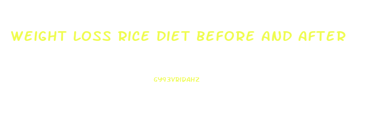 Weight Loss Rice Diet Before And After