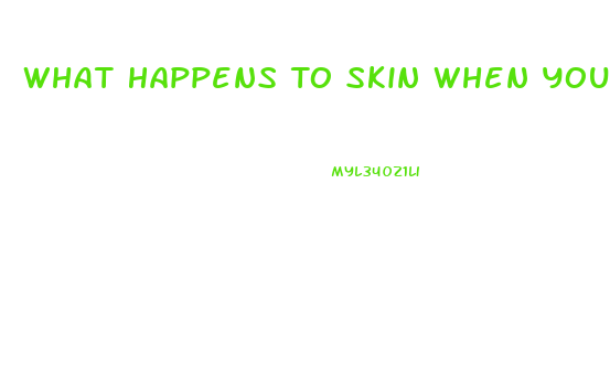 What Happens To Skin When You Lose Weight