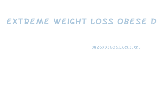 extreme weight loss obese diet plan