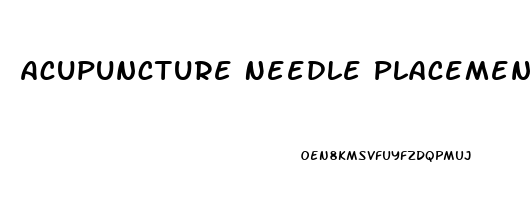 Acupuncture Needle Placement For Erectile Dysfunction