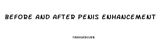 Before And After Penis Enhancement