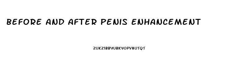 Before And After Penis Enhancement