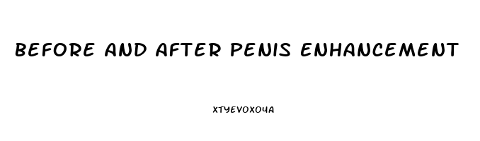 Before And After Penis Enhancement