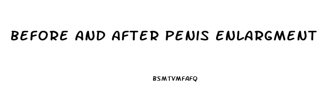 Before And After Penis Enlargment