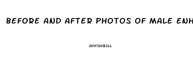 Before And After Photos Of Male Enhancement