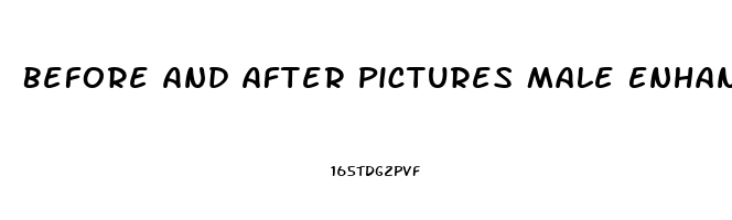 Before And After Pictures Male Enhancement