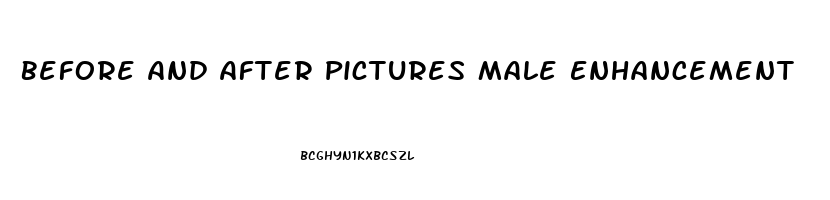 Before And After Pictures Male Enhancement