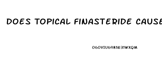 Does Topical Finasteride Cause Erectile Dysfunction