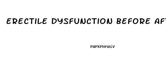 Erectile Dysfunction Before After Photos