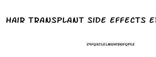 Hair Transplant Side Effects Erectile Dysfunction