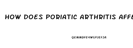 How Does Poriatic Arthritis Affect Sex Drive