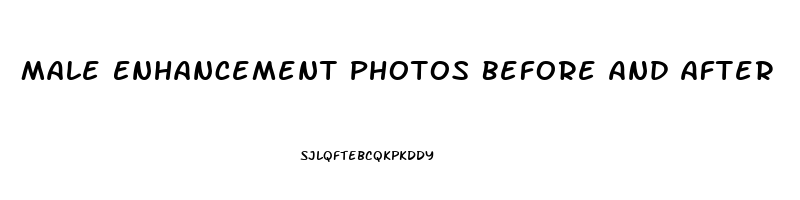 Male Enhancement Photos Before And After