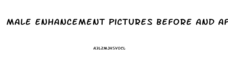 Male Enhancement Pictures Before And After