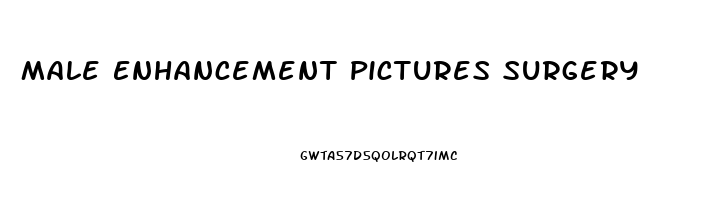 Male Enhancement Pictures Surgery