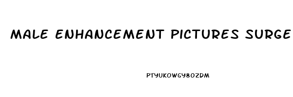 Male Enhancement Pictures Surgery