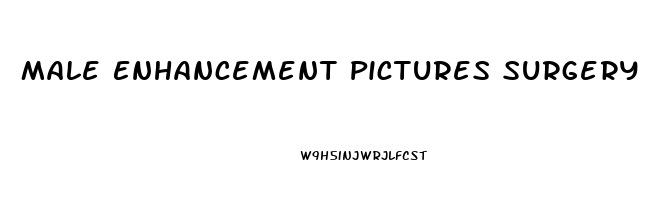 Male Enhancement Pictures Surgery