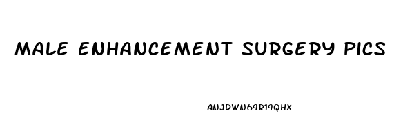 Male Enhancement Surgery Pics