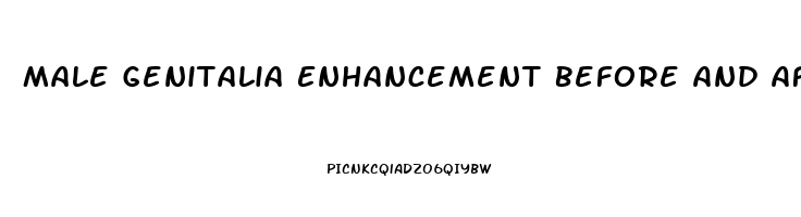 Male Genitalia Enhancement Before And After