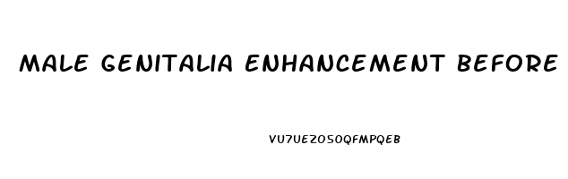 Male Genitalia Enhancement Before And After