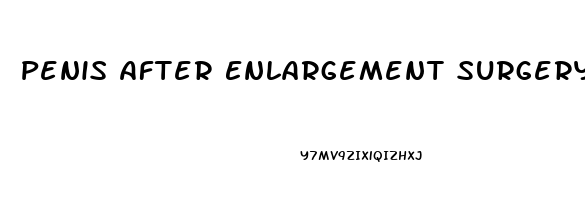 Penis After Enlargement Surgery