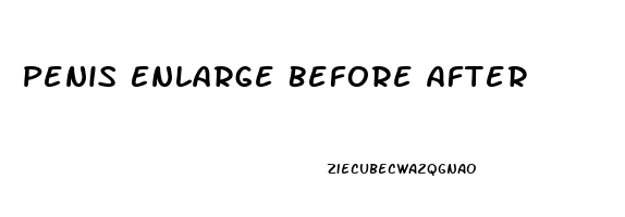 Penis Enlarge Before After