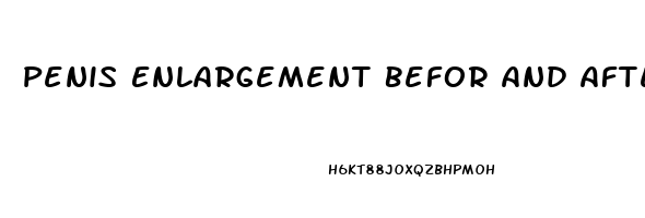 Penis Enlargement Befor And After