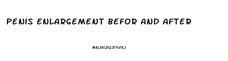 Penis Enlargement Befor And After