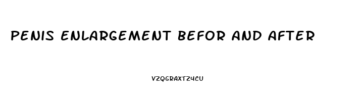 Penis Enlargement Befor And After