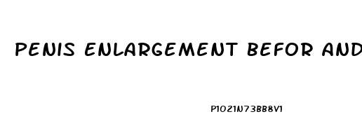 Penis Enlargement Befor And After