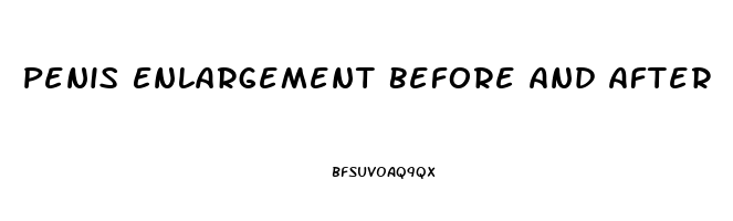 Penis Enlargement Before And After