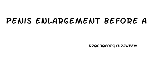 Penis Enlargement Before And After Erect