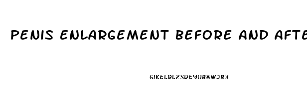 Penis Enlargement Before And After Photos