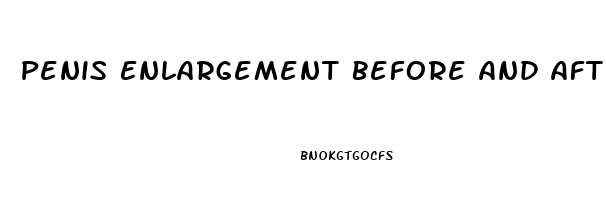 Penis Enlargement Before And After Pics