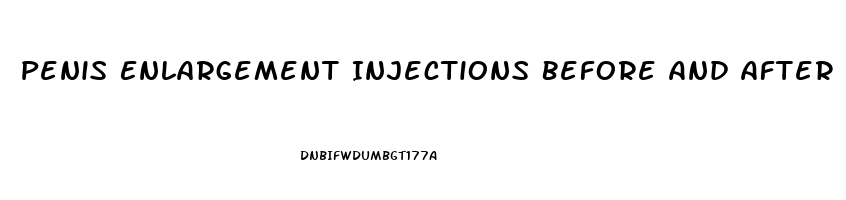 Penis Enlargement Injections Before And After