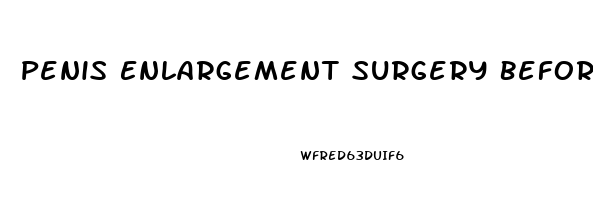 Penis Enlargement Surgery Before