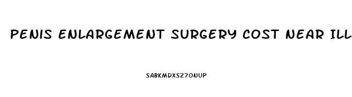 Penis Enlargement Surgery Cost Near Illinois