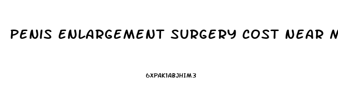 Penis Enlargement Surgery Cost Near Michigan