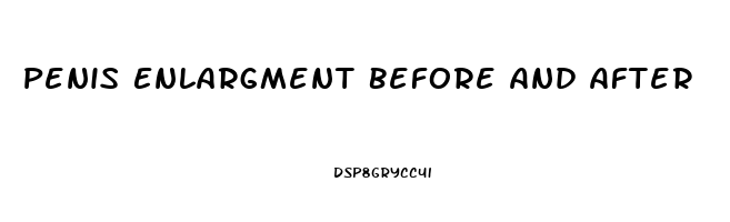 Penis Enlargment Before And After