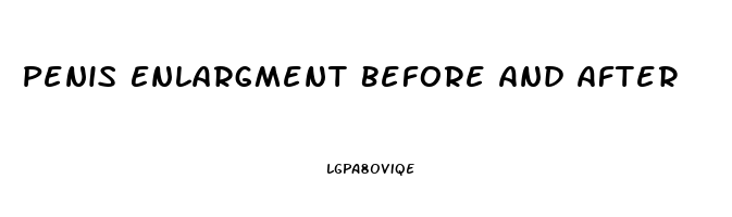 Penis Enlargment Before And After